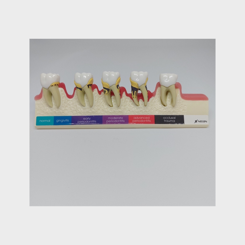 Parodontitis Studiemodel 